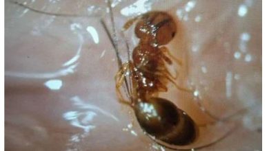 Photo of 男童午睡左眼剧痛惊醒 蚂蚁钻眼紧咬眼皮睫毛