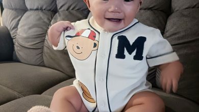 Photo of 2岁男童患多重先天缺陷 心脏手术需7万救命