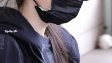 Photo of 杨幂脸部烫伤后首现身 带红痕开工获赞敬业