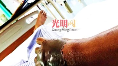 Photo of 鞋架有蛇 手伸进內被咬 男子紧急送院