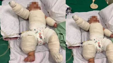 Photo of 5个月大男婴拉扯电锅电线 遭滚烫米汤泼淋全身烫伤
