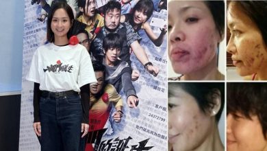 Photo of 拍戏连续掌掴宝珮如致爆血管 梁雍婷道歉:不知她动过手术