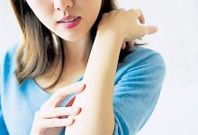 Photo of 运动及洗热水就痒 热过敏3招快速止痒