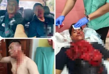 Photo of 吸毒者拒捕挥刀攻击 警员脸部遭严重割伤