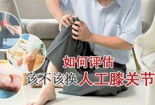 Photo of 【关节保养学】如何评估该不该换人工膝关节