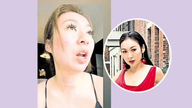 Photo of 脸部红疹延至颈部 庄思敏“好痛苦啊”