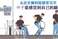 Photo of 【中西医复建专题(下)】从近全瘫到能提笔写字 终于能感觉到自己的腿