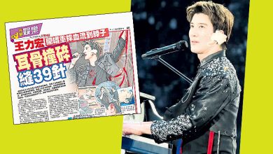 Photo of 王力宏缝完39针继续演唱会 还原伤势起来巨痛