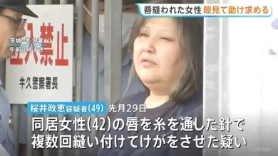 Photo of 嘴巴遭针线缝合 42岁女逃进店铺写纸条求救