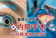 Photo of 【重塑好视力专题（2）】看得见还不够 白内障手术 迈向精准视力时代