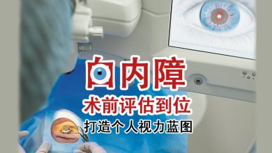 Photo of 【重塑好视力专题(4)】白内障术前评估到位 打造个人视力蓝图