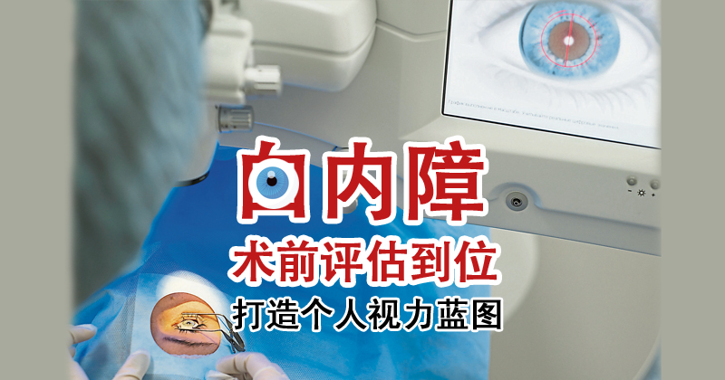 【重塑好视力专题（4）】白内障术前评估到位 打造个人视力蓝图