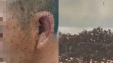 Photo of 险过鬼门关!男惨遭蜂群围攻 全身被扎近千根毒刺
