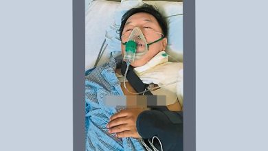 Photo of 骑脚车摔倒锁骨骨折 金马影帝黄渤“多么痛的领悟”