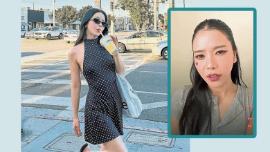 Photo of MAMAMOO颂乐美国街头遇袭 遭男子丢木櫈受伤