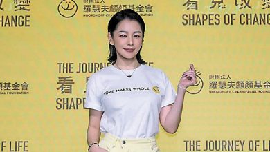 Photo of 徐若瑄  曝光全身7道疤