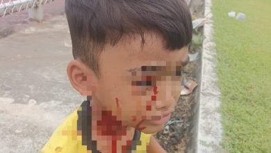 Photo of 再传野狗伤人 7岁童遭8恶狗撕咬