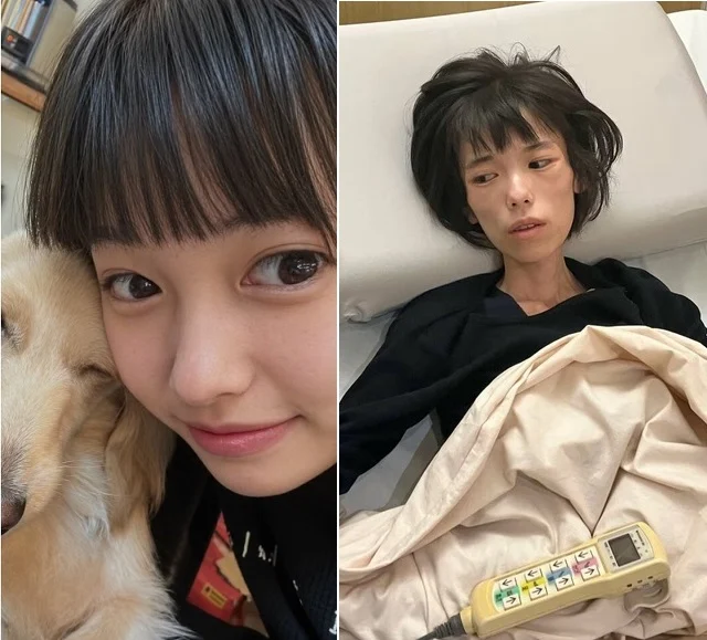 被拘留18天不准见母 16岁少女暴瘦至20公斤后身亡